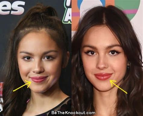 did olivia rodrigo get breast implants|Olivia Rodrigo Plastic Surgery: Boob Job and Lip。